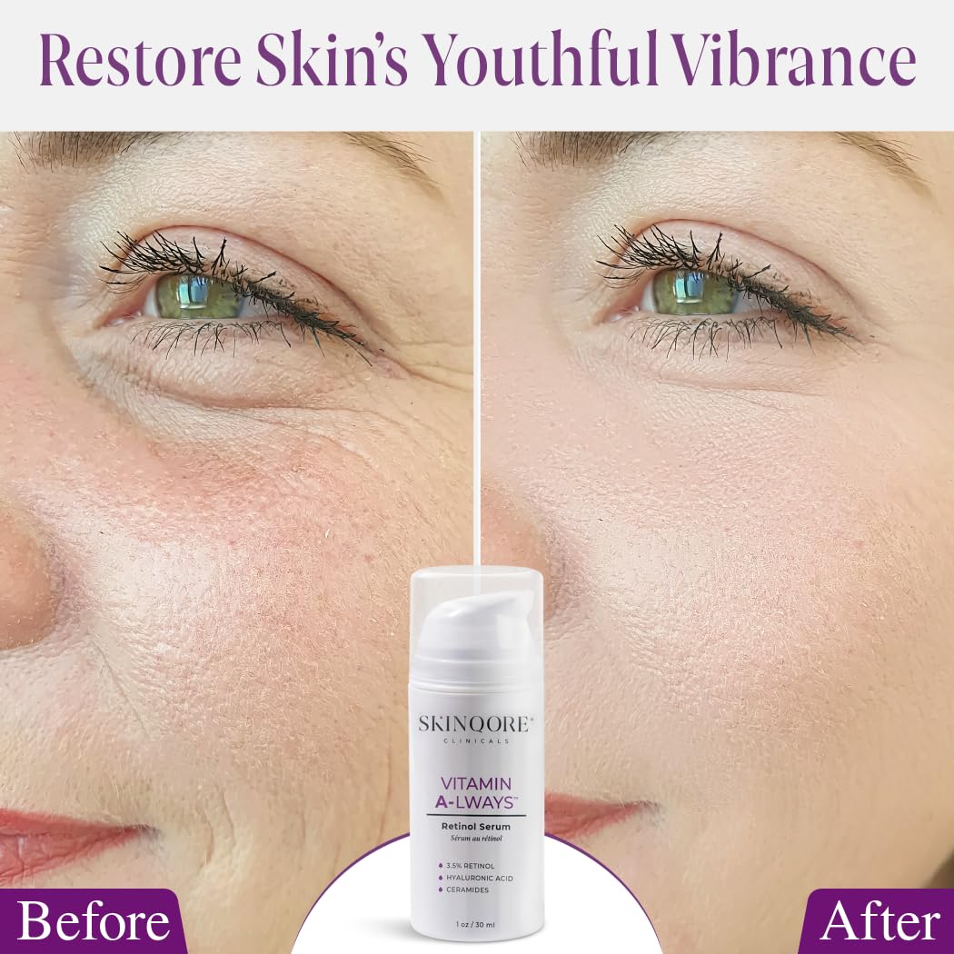 Vitamin A-lways Retinol Serum 1oz / 30ml